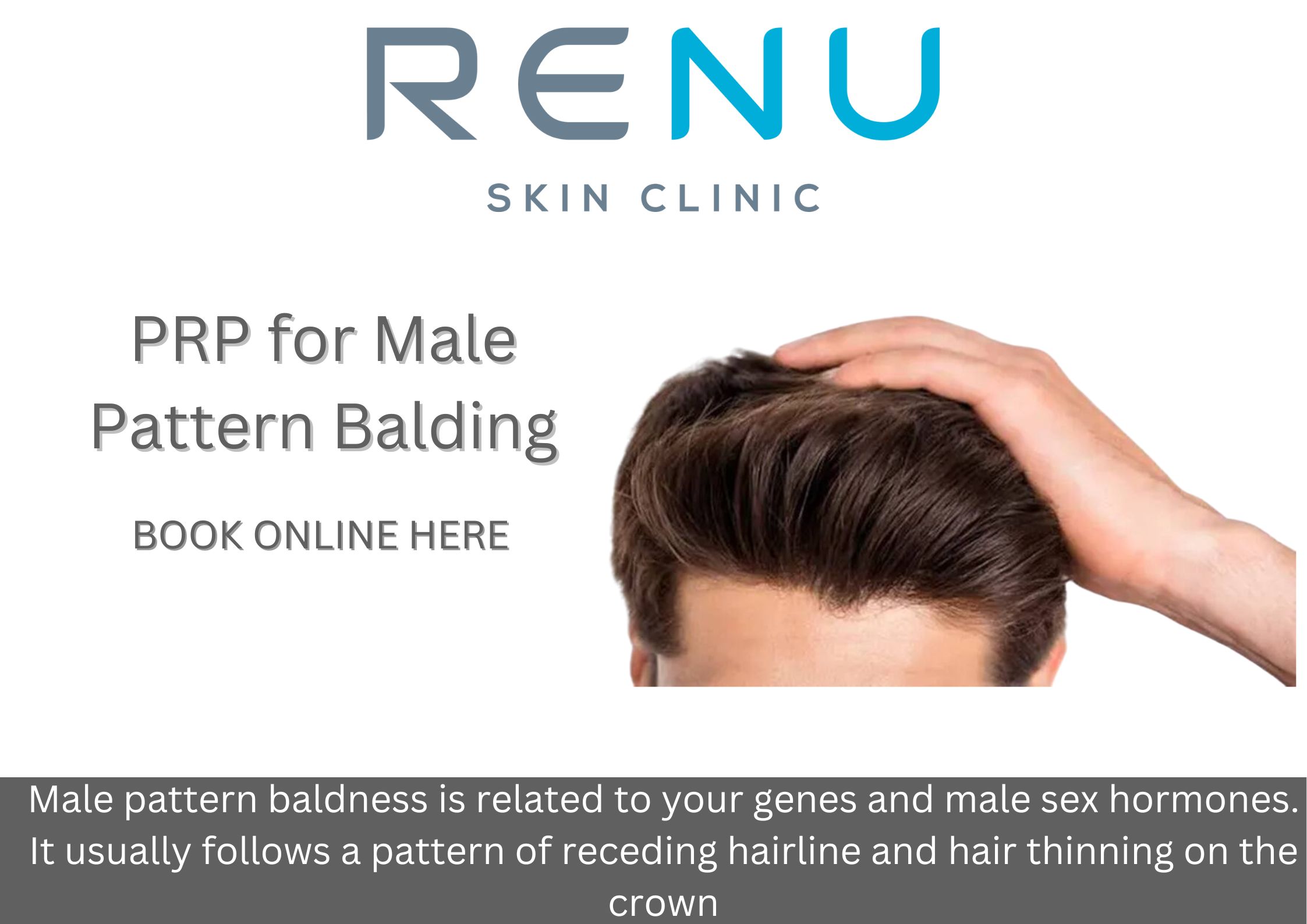 Male Pattern Baldness | Renu Skin Clinic