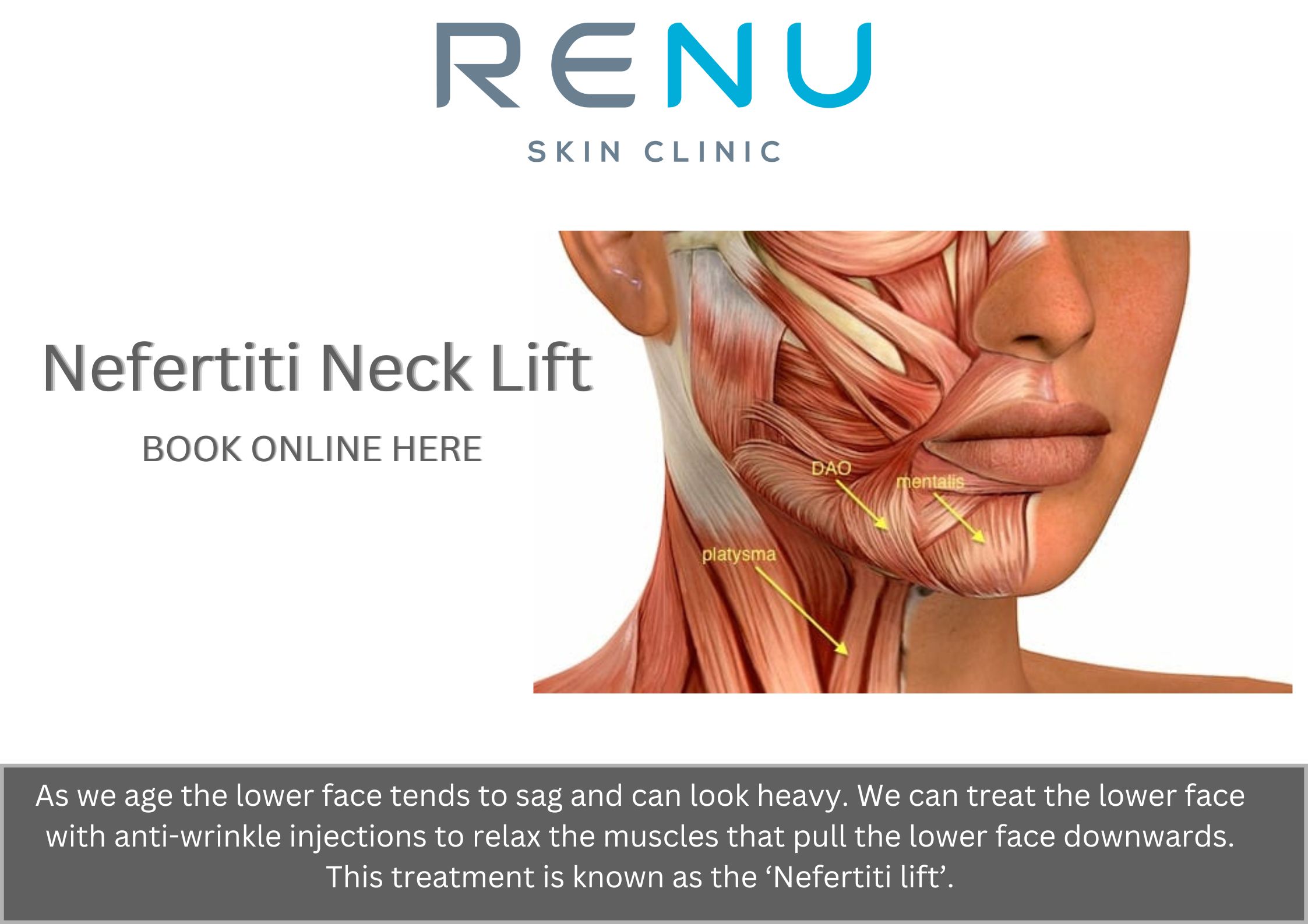 Nefertiti Neck Lift Renu Skin Clinic 
